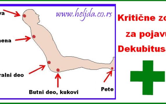 Kritične zone na telu za pojavu decubitusa